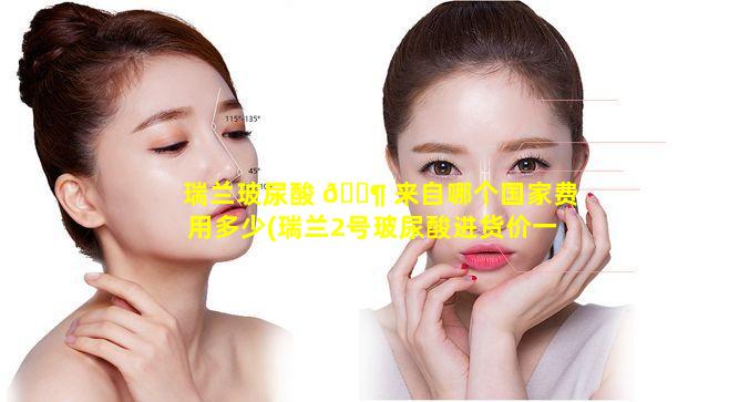 瑞兰玻尿酸 🐶 来自哪个国家费用多少(瑞兰2号玻尿酸进货价一般 🌵 多少)